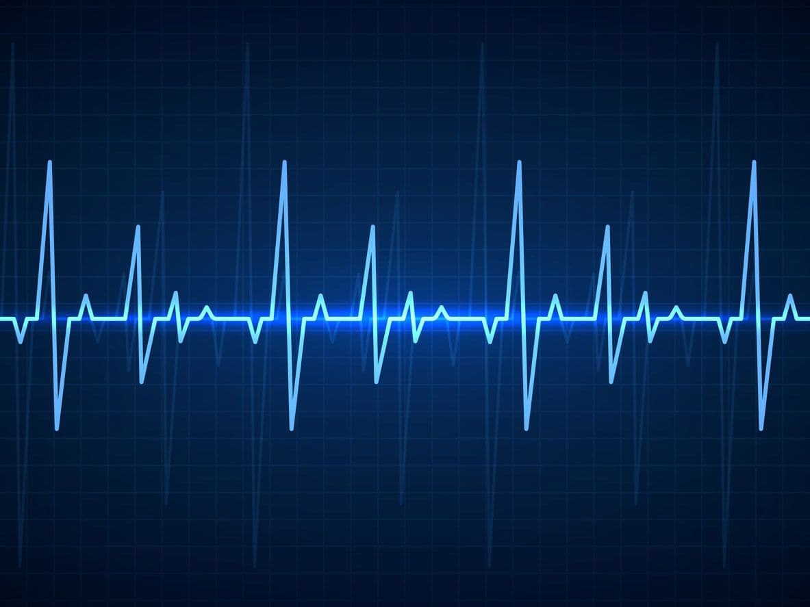 Heart Rate Variability (HRV): what it is, and why it matters to your health and your sleep